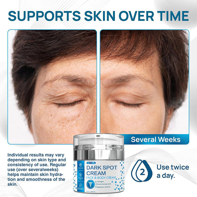 Dark Spot Cream